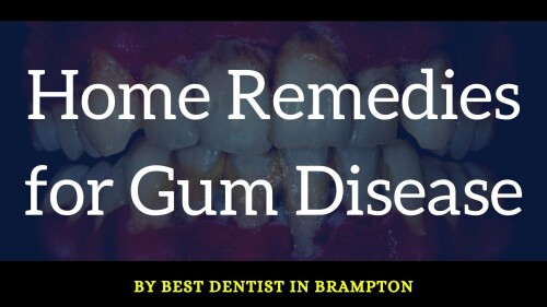 Salt
Alcohol
Apple cider vinegar
Lemon
Knoblauch Garlic
Herbs
Propolis
Coconut oil and other vegetable oils
Tea tree oil

Click here to read in detail: https://bestdentistinbrampton.blogspot.com/2021/09/home-remedies-for-gum-disease.html