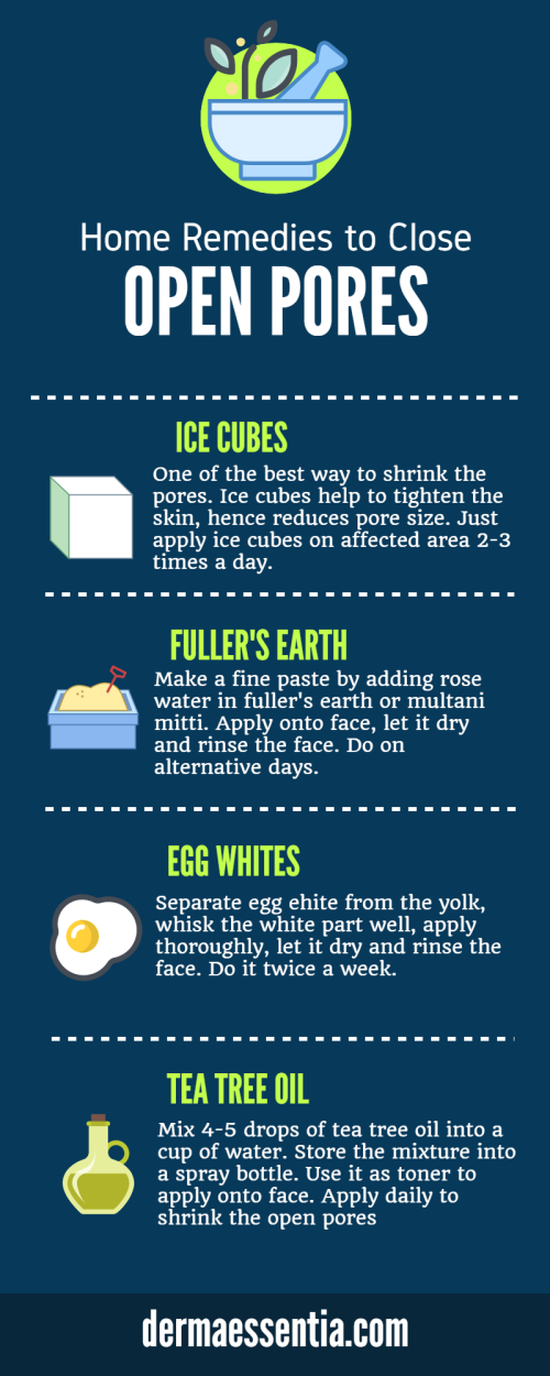 The problem of open pores really can be a headache. If you are also suffering from this skin concern, try amazingly easy to use effective home remedies like ice cubes, white egg part, multani mitti and tea tree oil to shrink and reshape your enlarged open pores. It will help to makes your skin flawless and smooth.