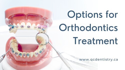 Braces to correct a Misaligned Bite
Traditional Metal Braces
Clear Braces
Invisalign Clear Aligners
Partial Orthodontic Treatment
Two-Phase Orthodontic Treatment for Young Children

Click Here to read in detail: https://qcdentistry.blogspot.com/2021/11/options-for-orthodontics-treatment.html