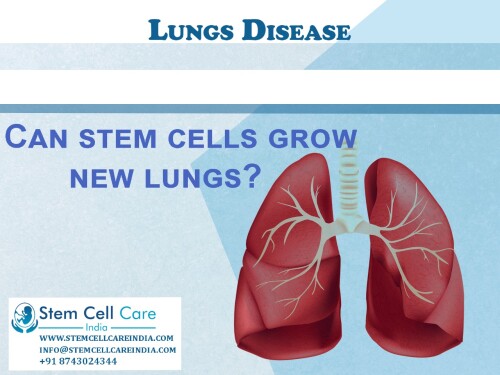 Differentiation is the capacity of stem cells to transform into any kind of cell in the body. Damaged tissues surrounding organs may be found using these intravenously injected probes. Visit us https://bit.ly/3HsDqIW