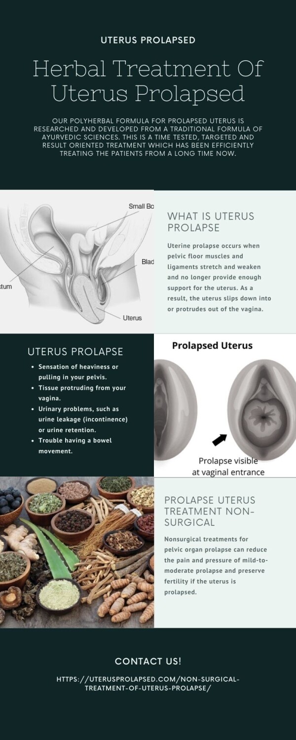 Are you looking for Herbal treatment of uterus prolapsed then must visit Kalpataru Herbal Therapy Centre they offered the best Ayurveda treatment for Uterus Prolapsed. Visit us https://bit.ly/3vknlBB