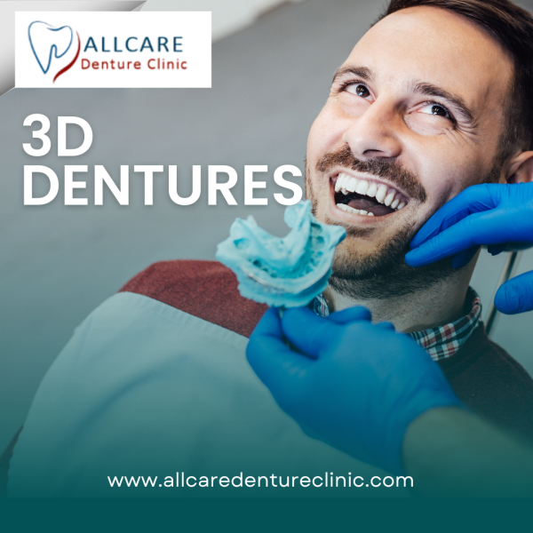 Looking for a way to improve your smile? Why not try 3d dentures in Abbotsford? With these remarkable dental implants, you can enjoy a beautiful, natural smile that's perfect for your unique facial features. And unlike traditional dental implants, which are placed into the jawbone, 3d dentures are actually placed into the teeth themselves - this makes them much more comfortable and easier to wear. Plus, because they're made with 3D technology, they offer an incredibly realistic appearance. So if you're searching for a way to improve your smile, look no further than Allcare Denture Clinic.

For more info:-https://www.allcaredentureclinic.com/complete-denture/