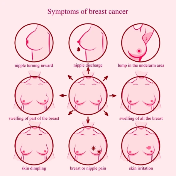 Symptoms of Breast Cancer

Breast Lump: The presence of a painless lump or thickening in the breast.
Changes in Breast Appearance: Such as dimpling, puckering, or redness of the skin.
Nipple Changes: Including nipple inversion, discharge, or scaling.

Breast Pain: Unexplained and persistent pain or discomfort.

Swelling of the Breast: Particularly if it's accompanied by warmth, redness, or an unusual sensation.

follow this link for more details https://drjayanam.com/