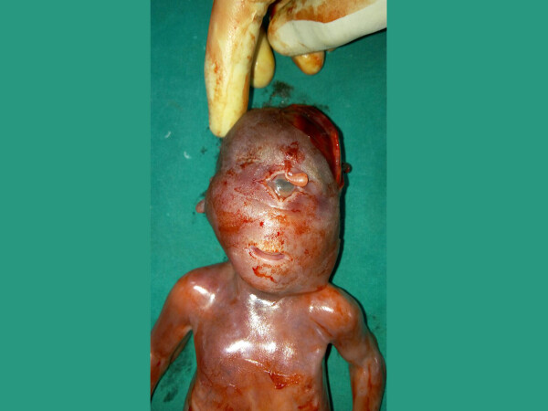 Deforned-Fetus5c2dcf1c615c9db7.jpg